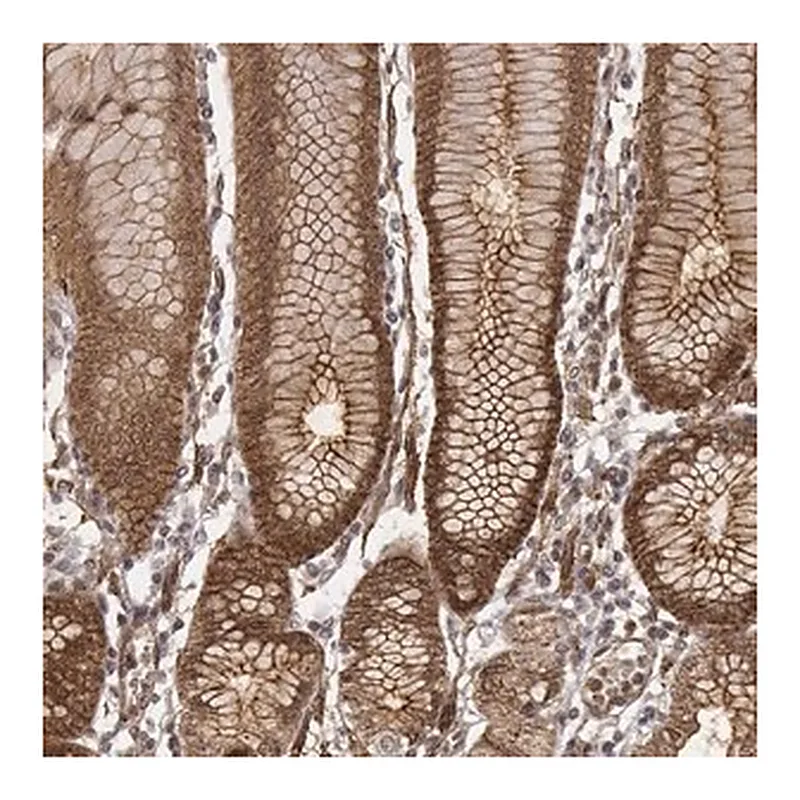 Merck Anti-ZFYVE19 antibody produced in rabbit | 캐시바이