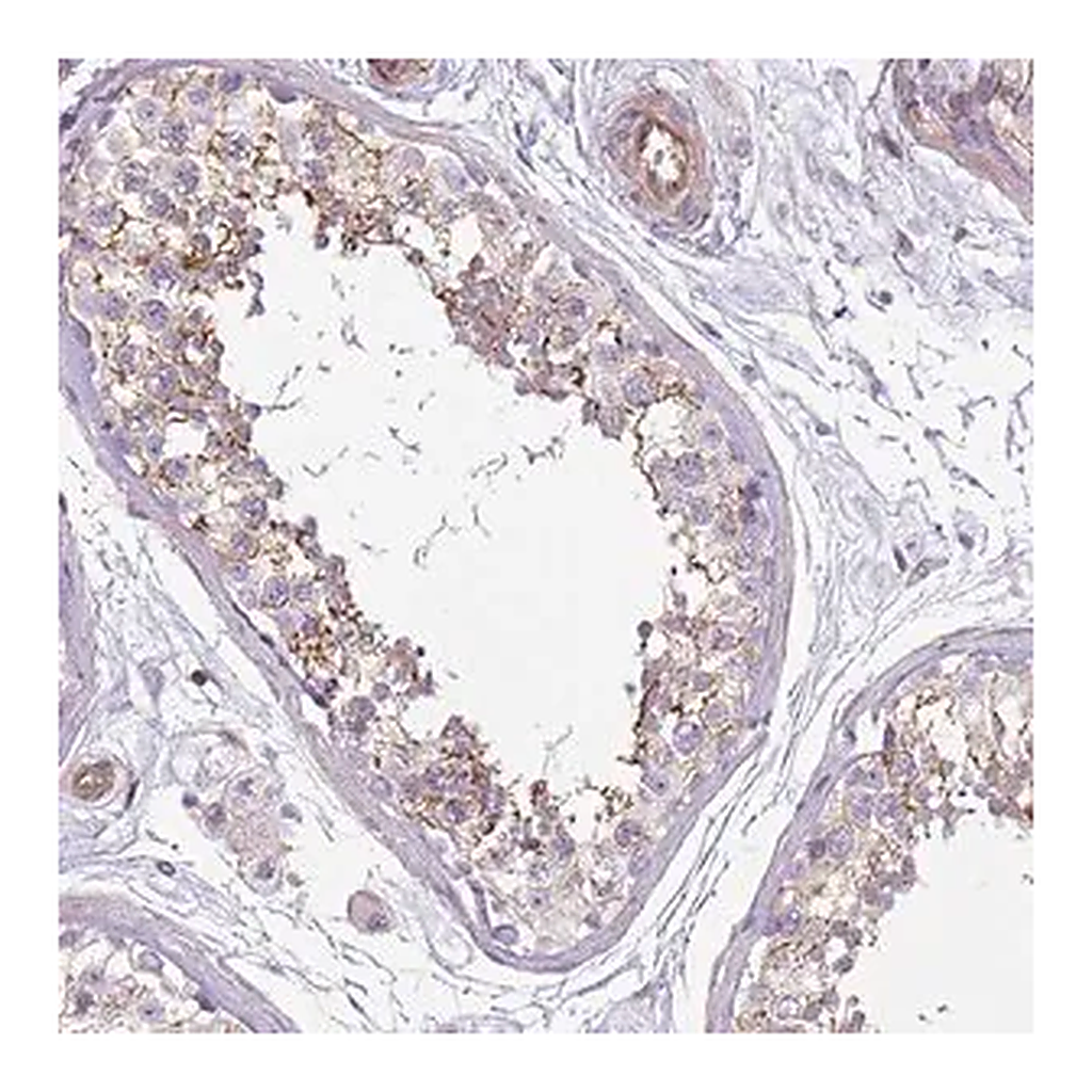 Merck Anti-GNAI1 antibody produced in rabbit