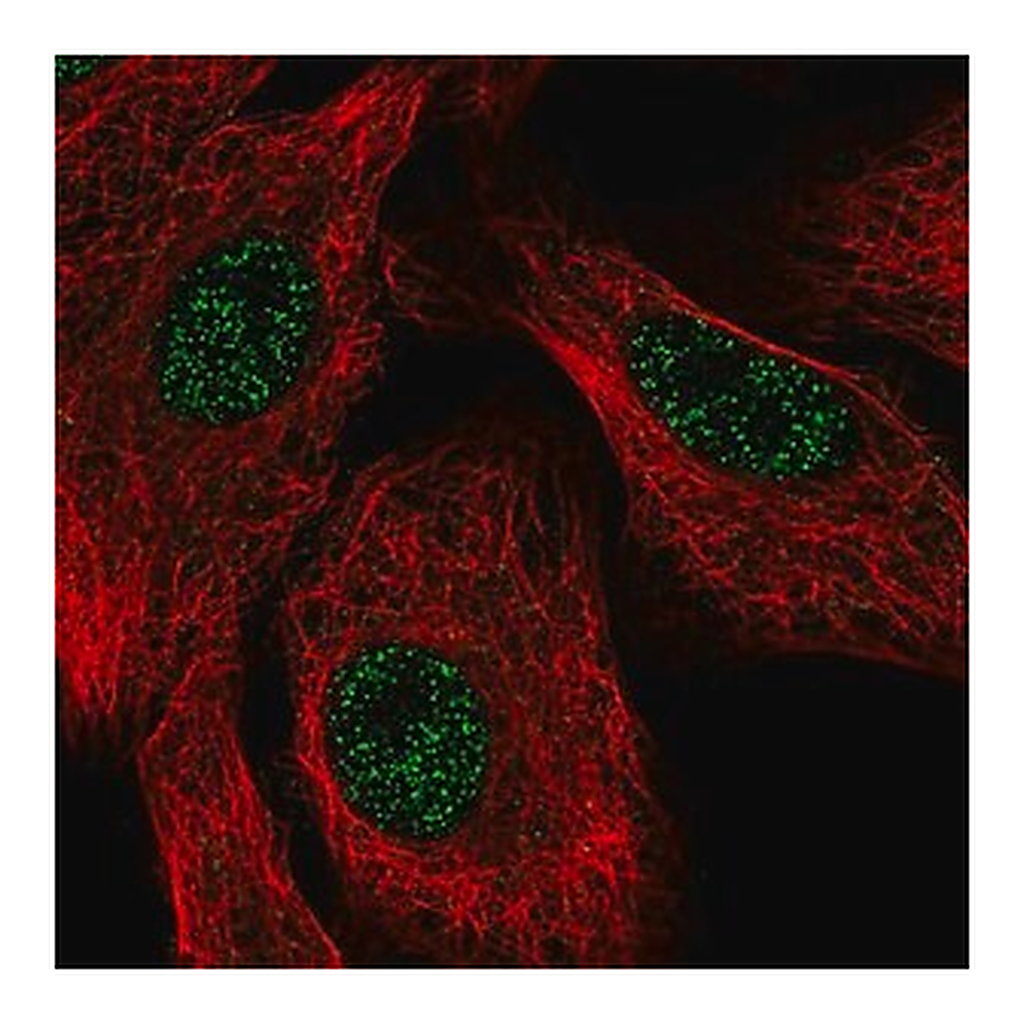 Merck Anti-SETX antibody produced in rabbit