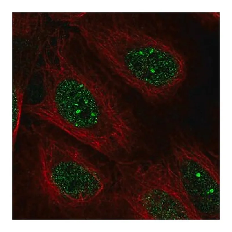 Merck Anti-POLK antibody produced in rabbit