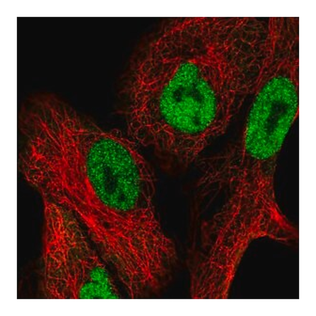 Merck Anti-NFAT5 antibody produced in rabbit