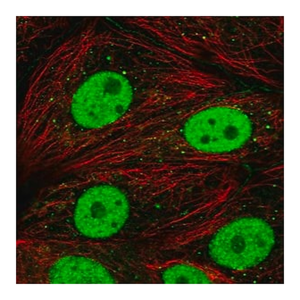 Merck Anti-DCP2 antibody produced in rabbit