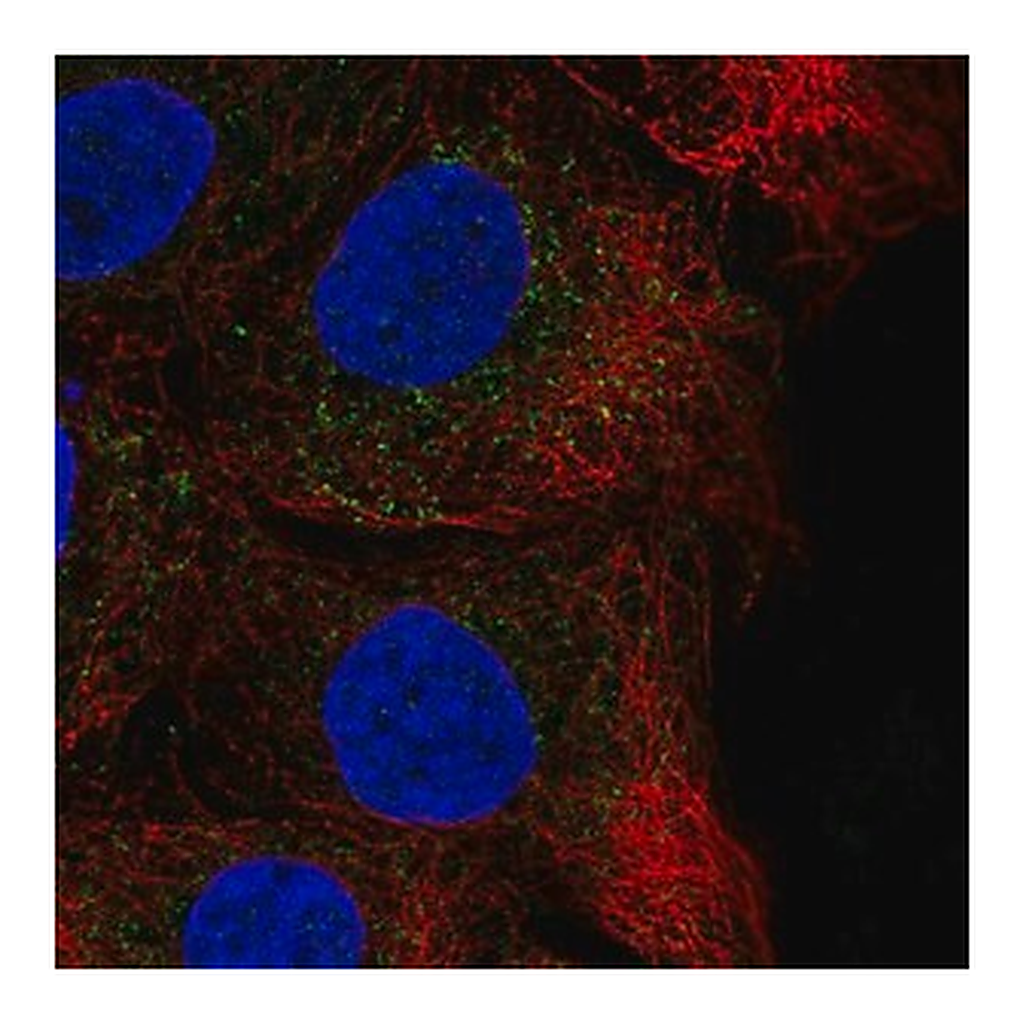Merck Anti-CHST14 antibody produced in rabbit