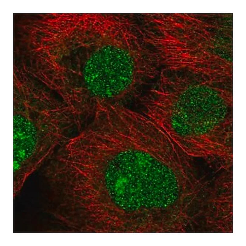 Merck Anti-MFSD1 antibody produced in rabbit