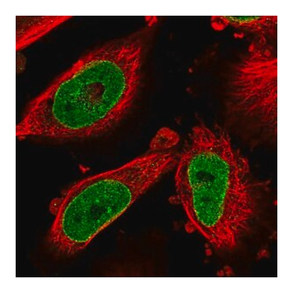 Merck Anti-NSUN3 antibody produced in rabbit