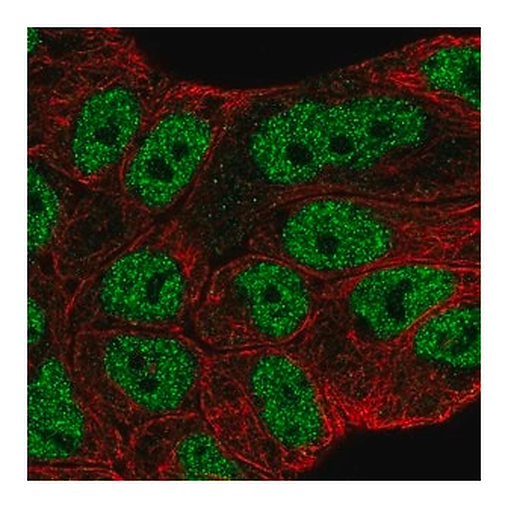 Merck Anti-ABCA6 antibody produced in rabbit