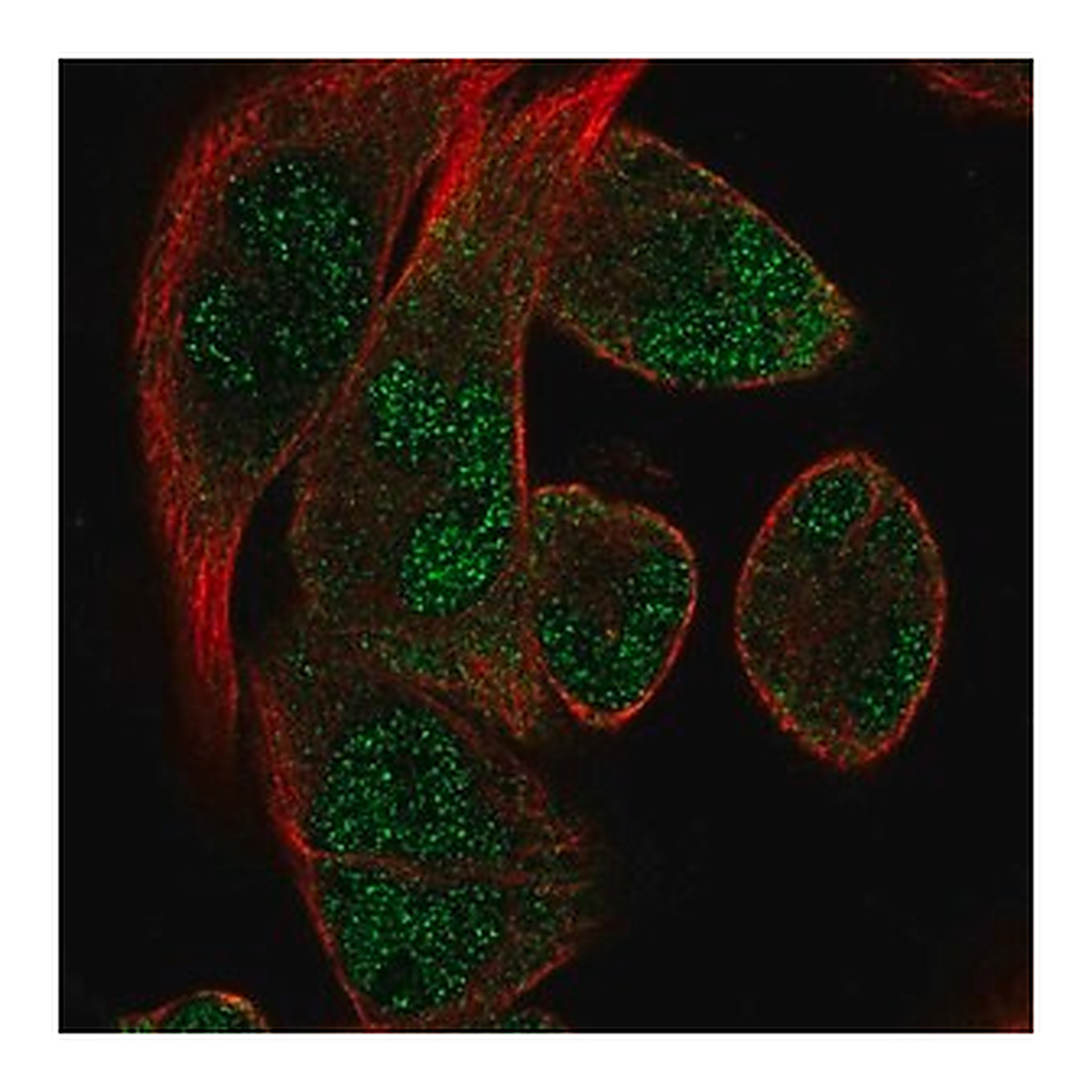 Merck Anti-RBM24 antibody produced in rabbit