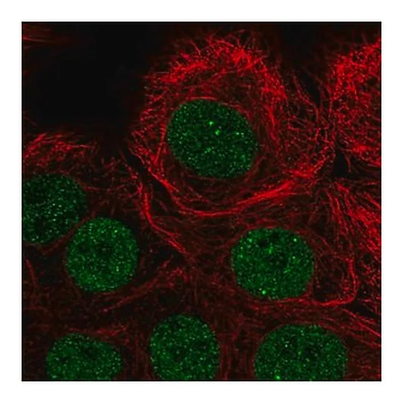 Merck Anti-PIAS3 antibody produced in rabbit