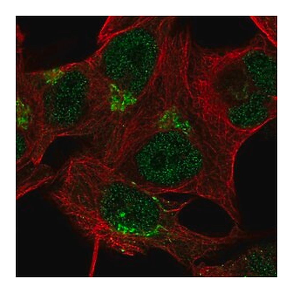 Merck Anti-TBC1D14 antibody produced in rabbit