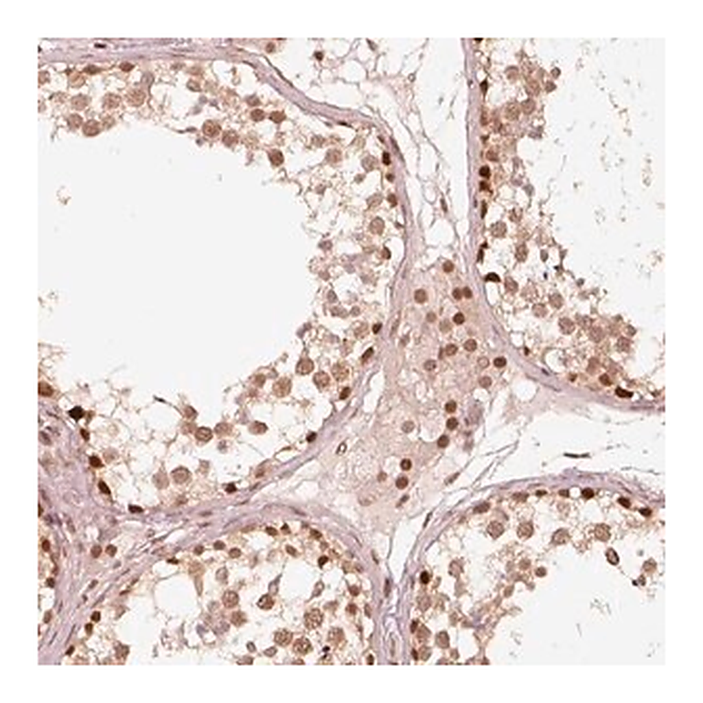 Merck Anti-GMEB2 antibody produced in rabbit