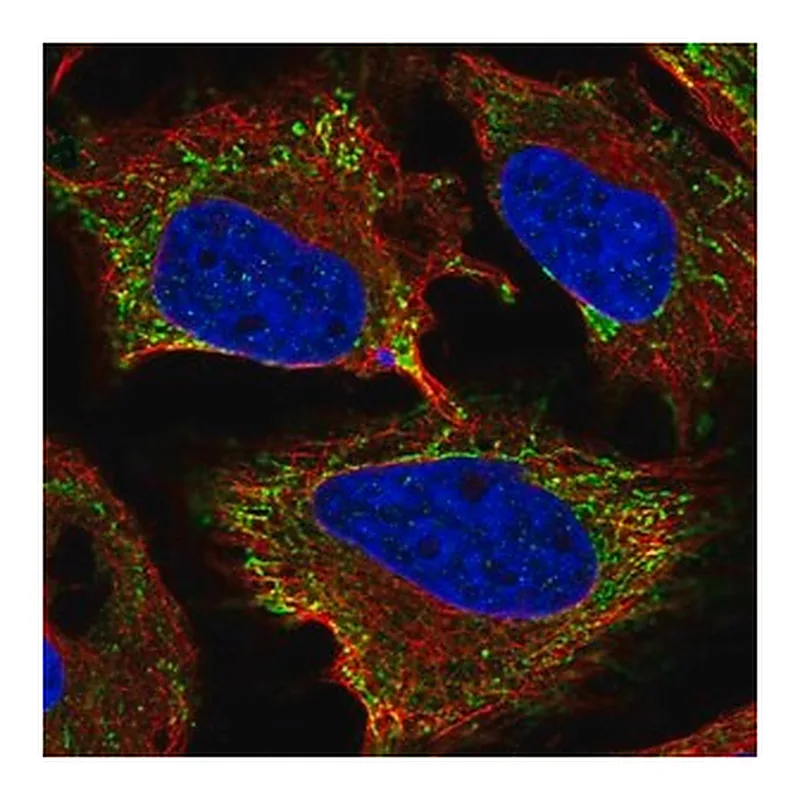 Merck Anti-KIAA1161 antibody produced in rabbit