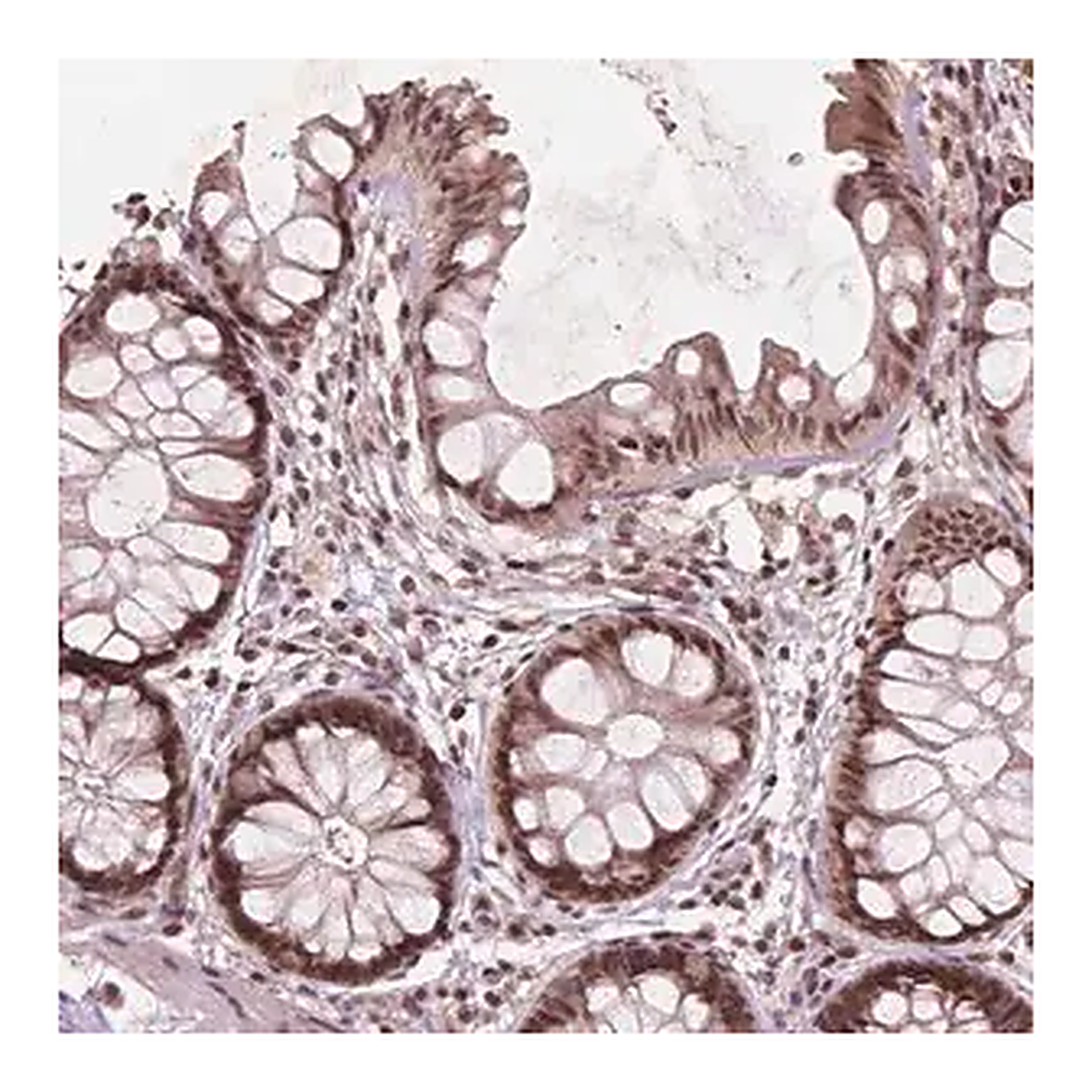 Merck Anti-GPS2 antibody produced in rabbit