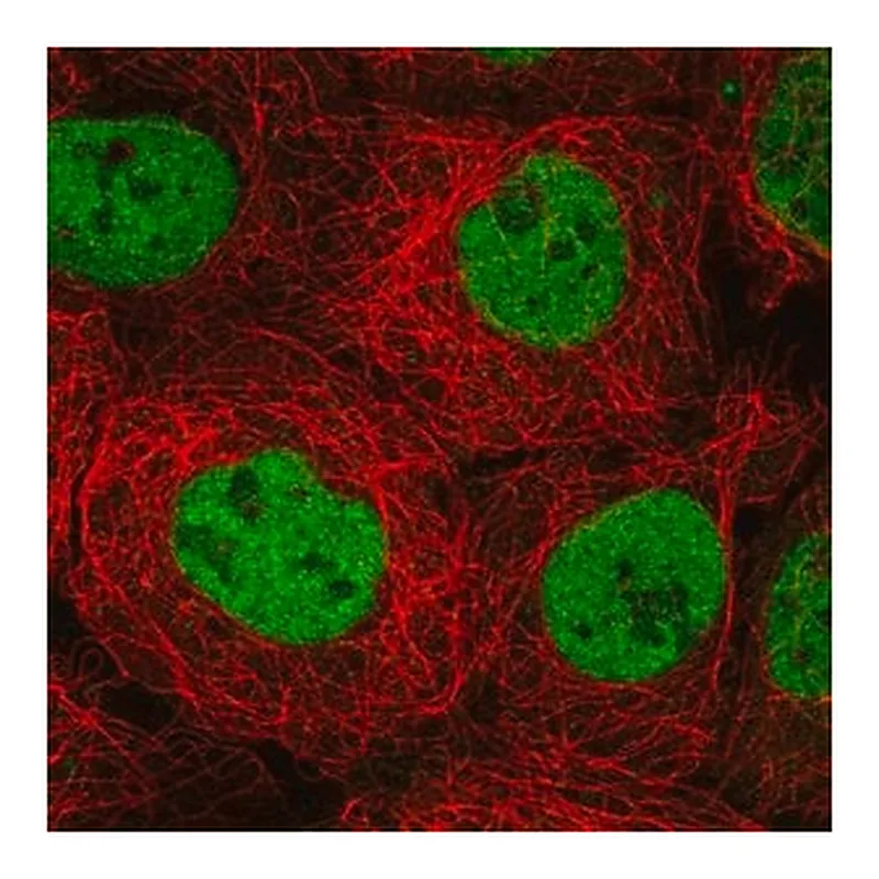 Merck Anti-MBD2 antibody produced in rabbit