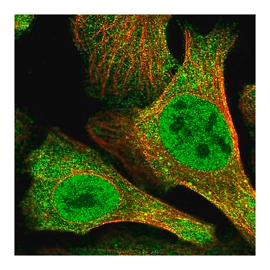 Merck Anti-N4BP2 antibody produced in rabbit