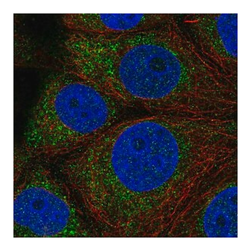 Merck Anti-QTRT1 antibody produced in rabbit