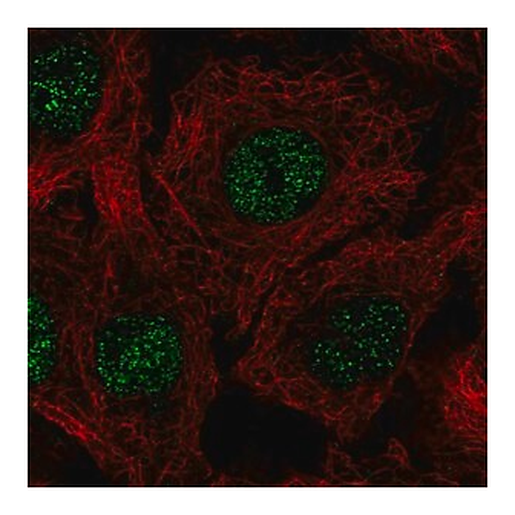 Merck Anti-C17orf50 antibody produced in rabbit