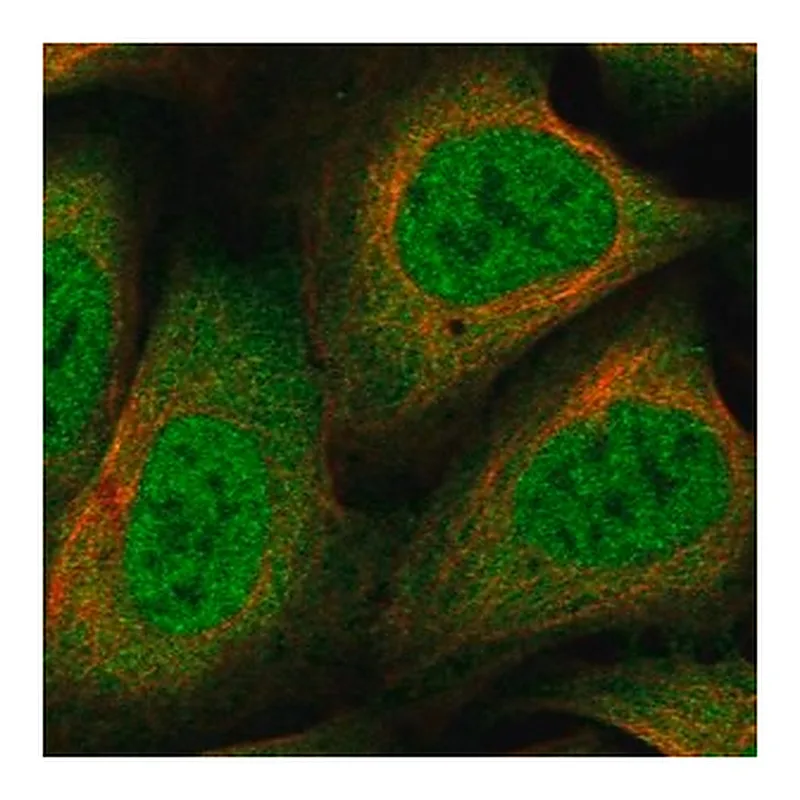 Merck Anti-NCOR1 antibody produced in rabbit