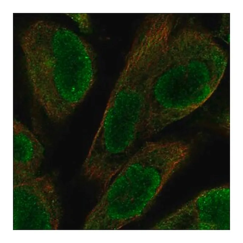 Merck Anti-UACA antibody produced in rabbit