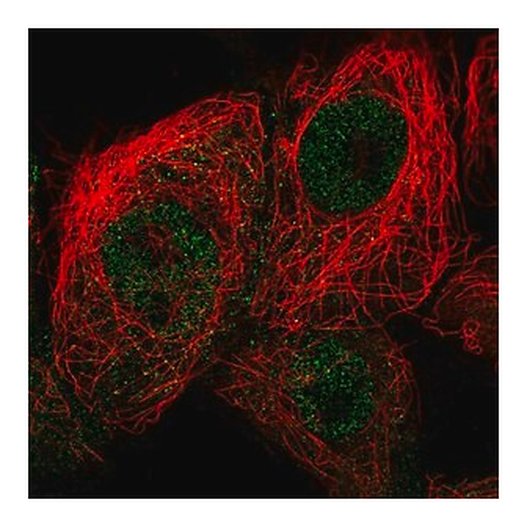 Merck Anti-CDKN2D antibody produced in rabbit