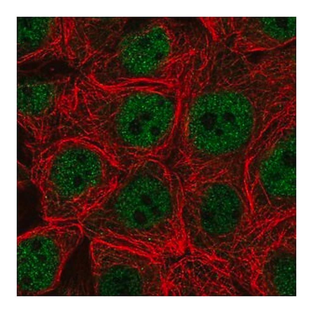 Merck Anti-CARM1 antibody produced in rabbit