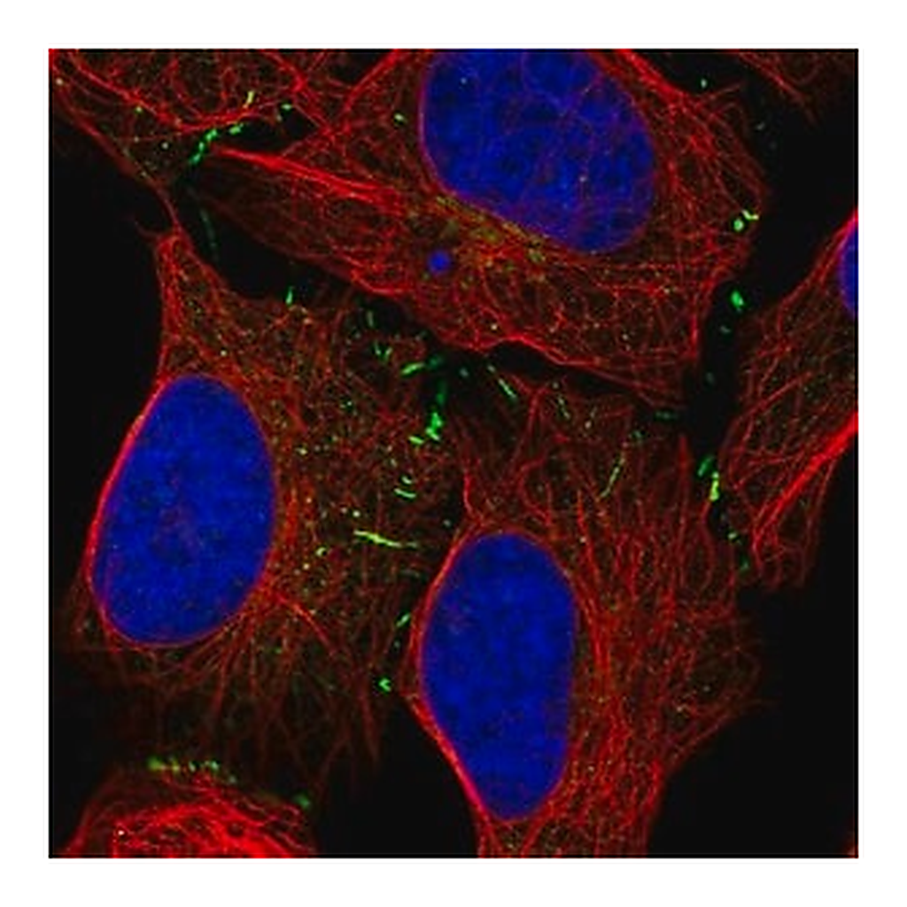 Merck Anti-VPS13B antibody produced in rabbit