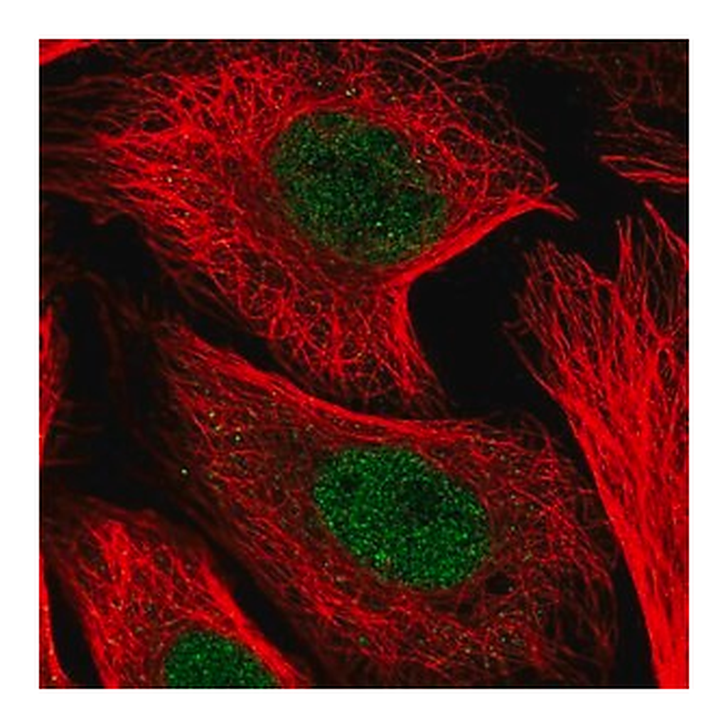 Merck Anti-KDELC1 antibody produced in rabbit