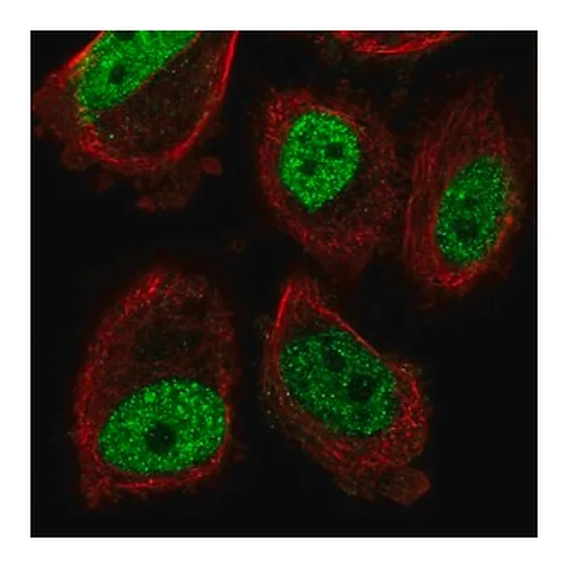 Merck Anti-ABHD8 antibody produced in rabbit