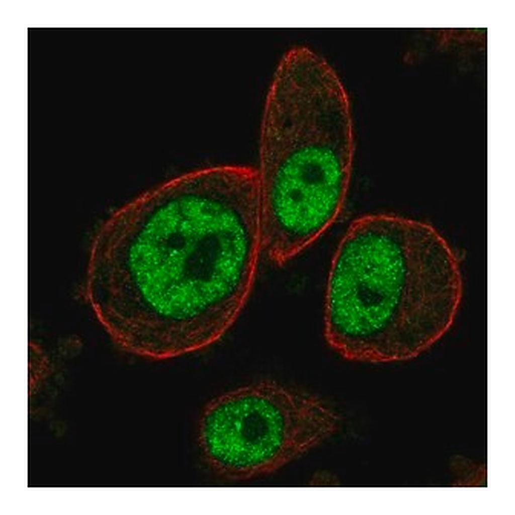 Merck Anti-MAPKAPK3 antibody produced in rabbit