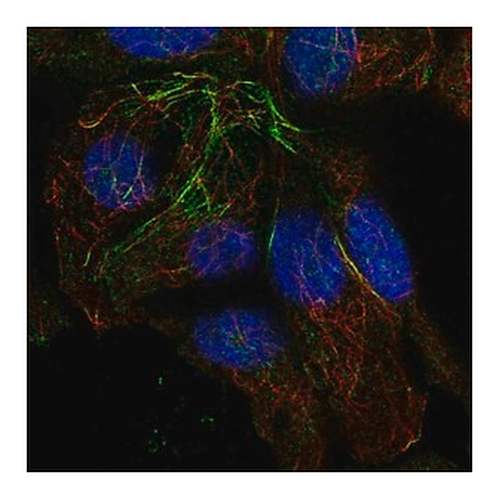 Merck Anti-TRMT10A antibody produced in rabbit