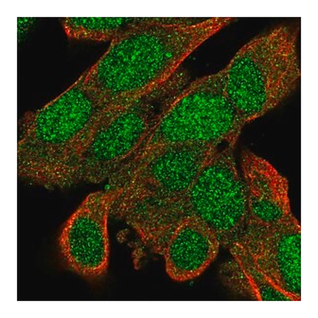 Merck Anti-BACH2 antibody produced in rabbit