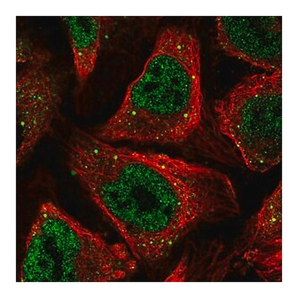 Merck Anti-CSRNP1 antibody produced in rabbit