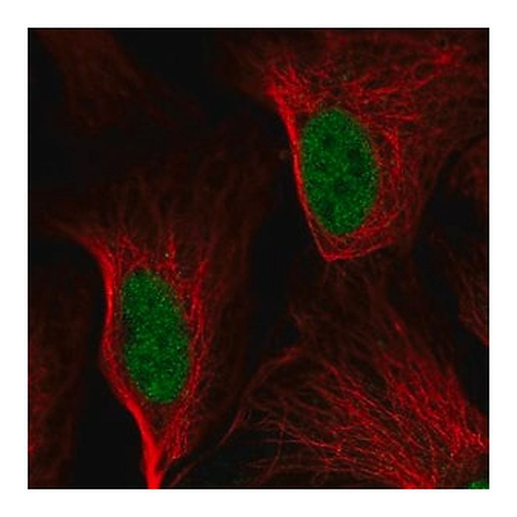 Merck Anti-DDIT3 antibody produced in rabbit