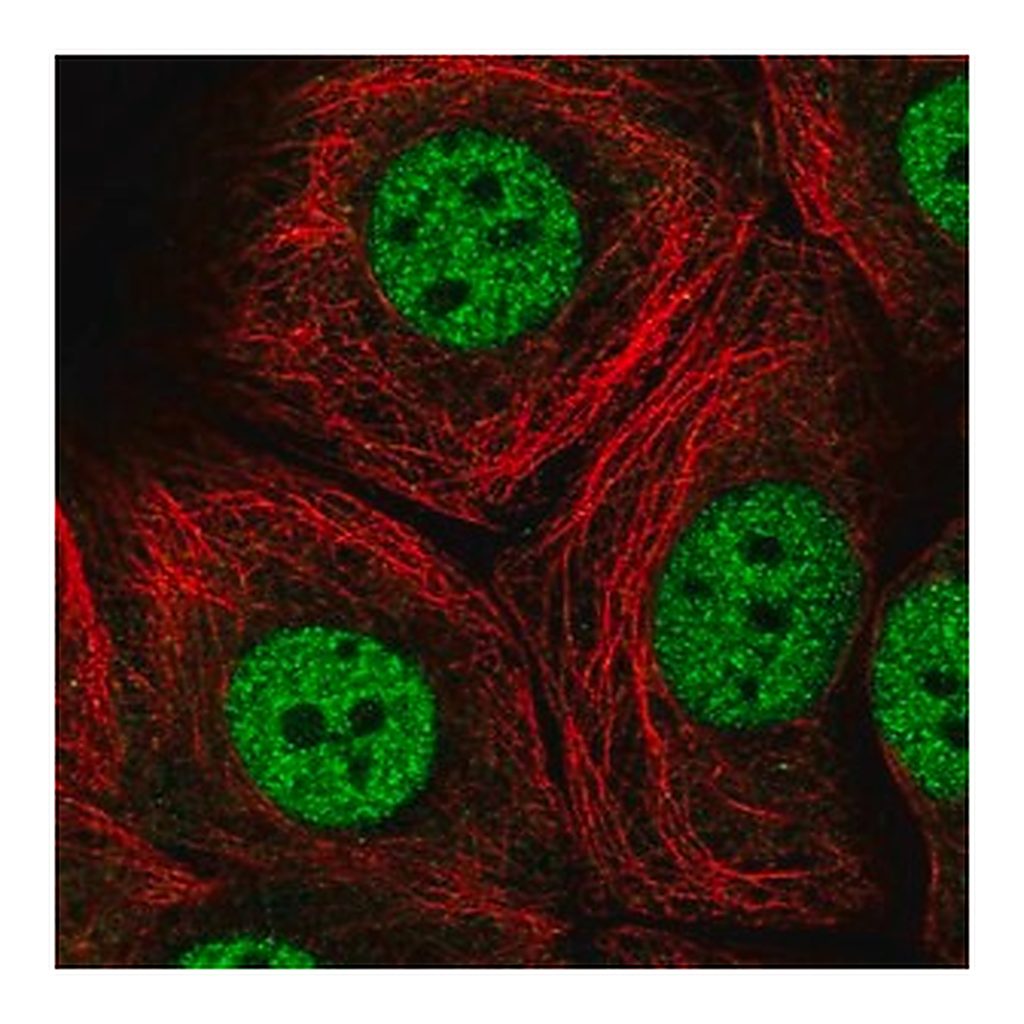 Merck Anti-MED13 antibody produced in rabbit