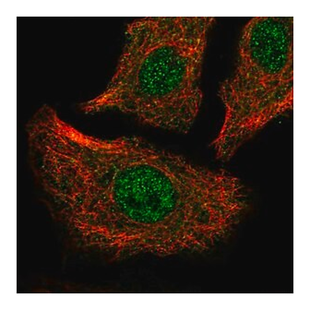 Merck Anti-ATP2A2 antibody produced in rabbit