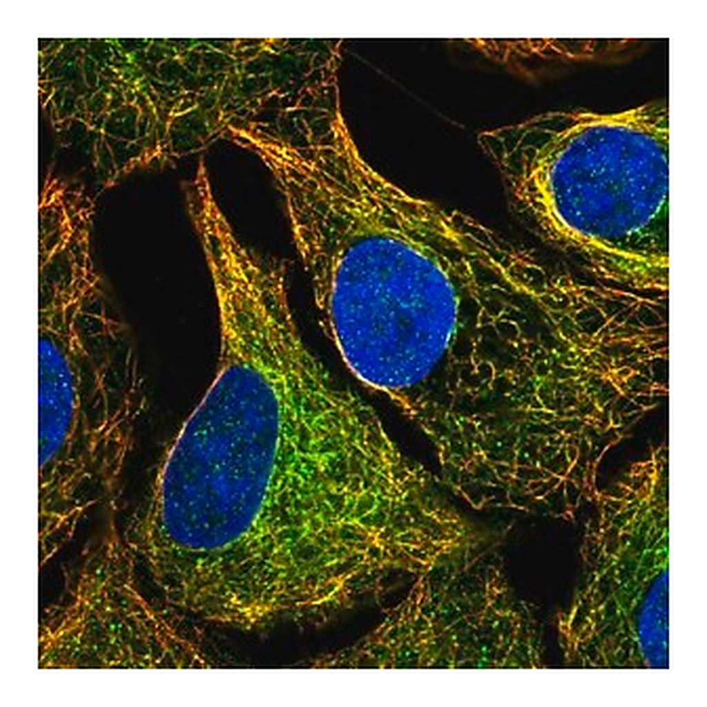 Merck Anti-MTUS1 antibody produced in rabbit