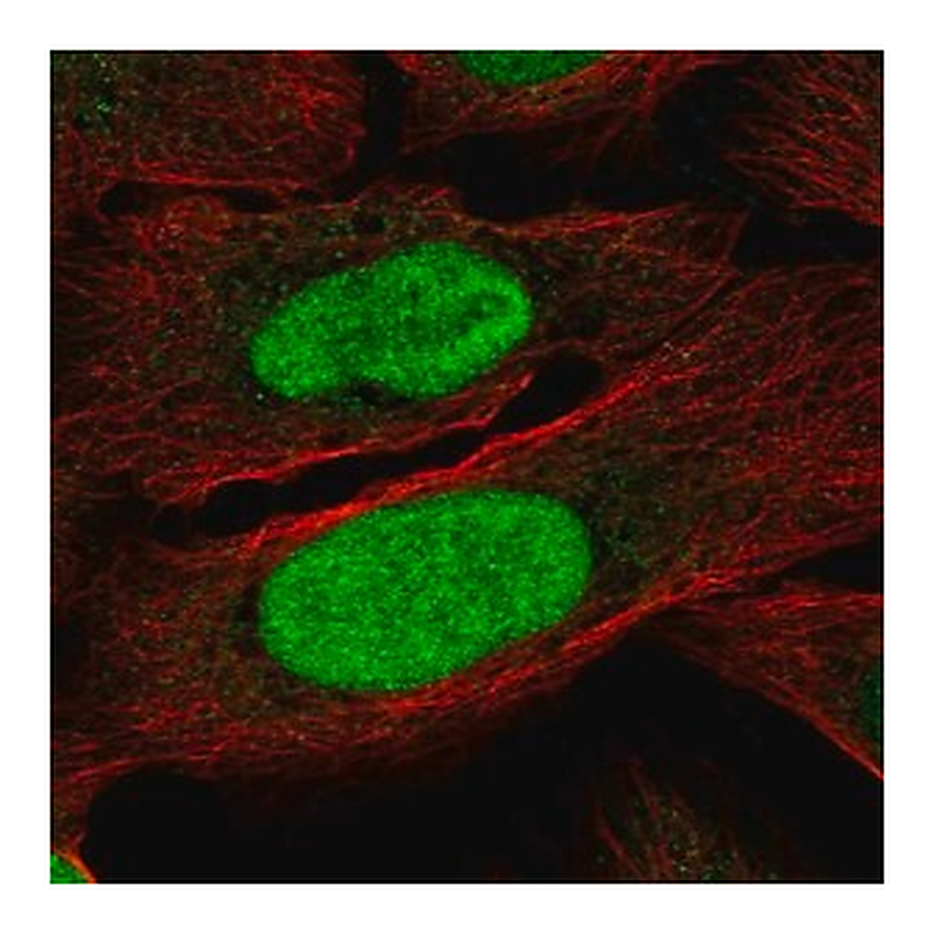 Merck Anti-ZNF776 antibody produced in rabbit