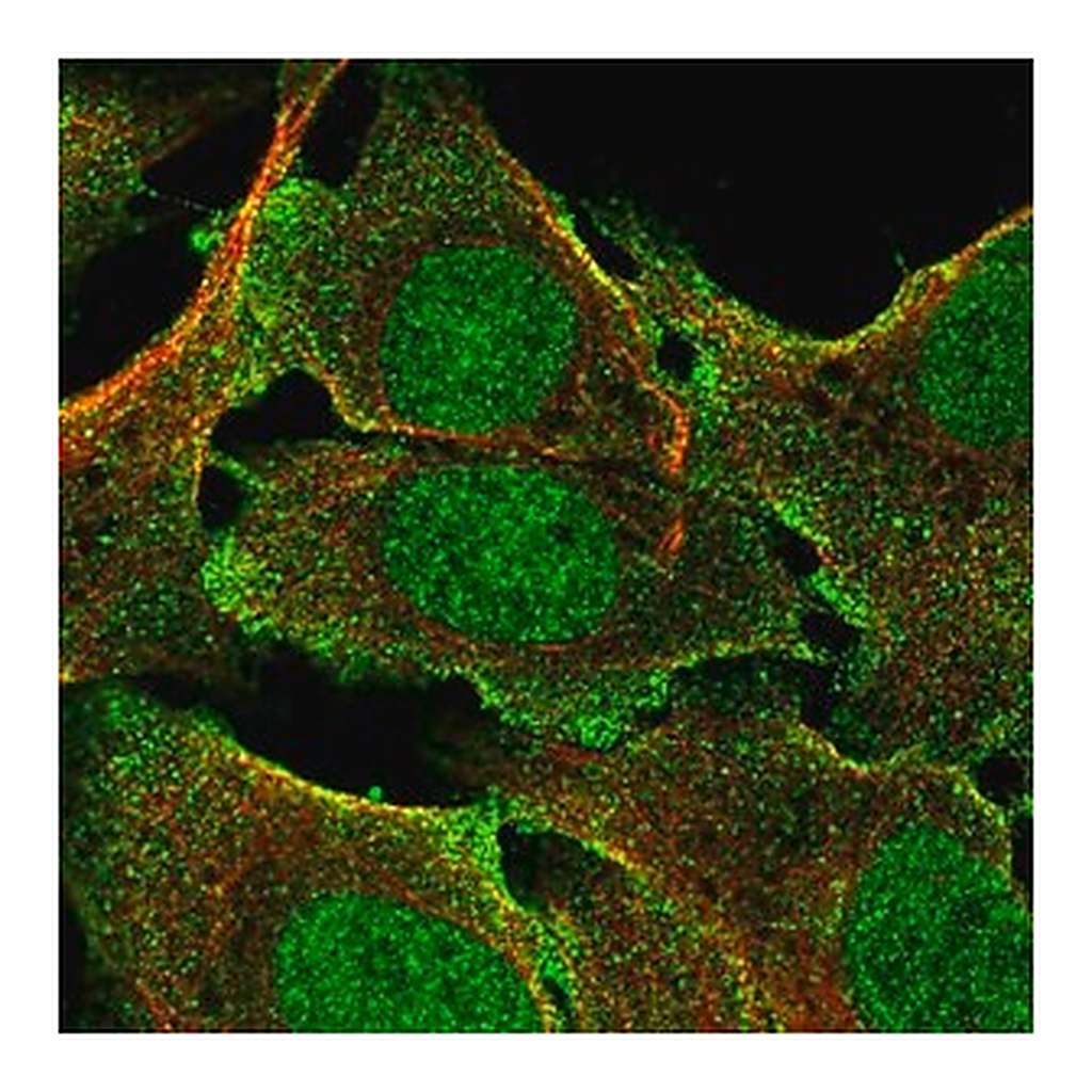 Merck Anti-BCORL1 antibody produced in rabbit