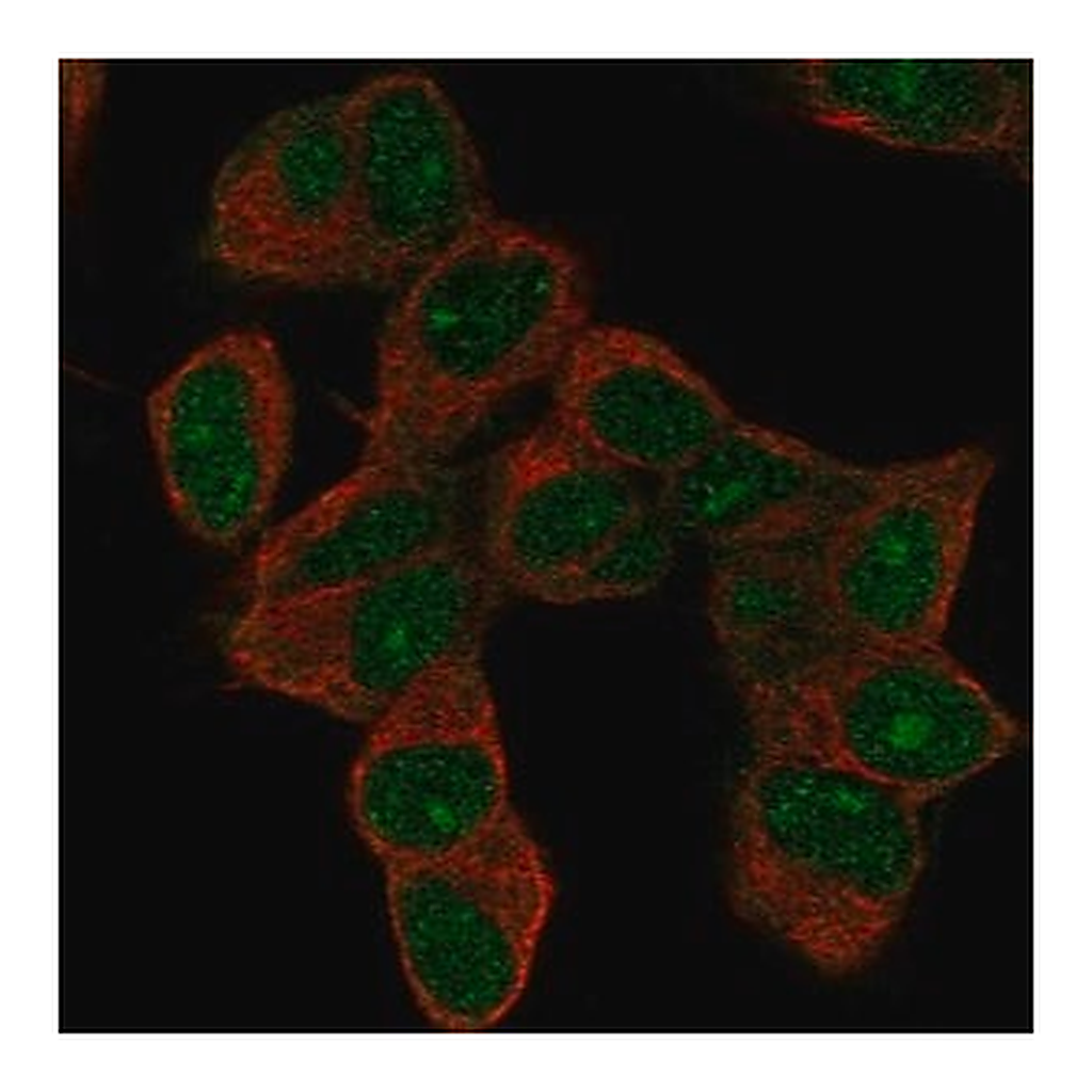 Merck Anti-HOXD9 antibody produced in rabbit