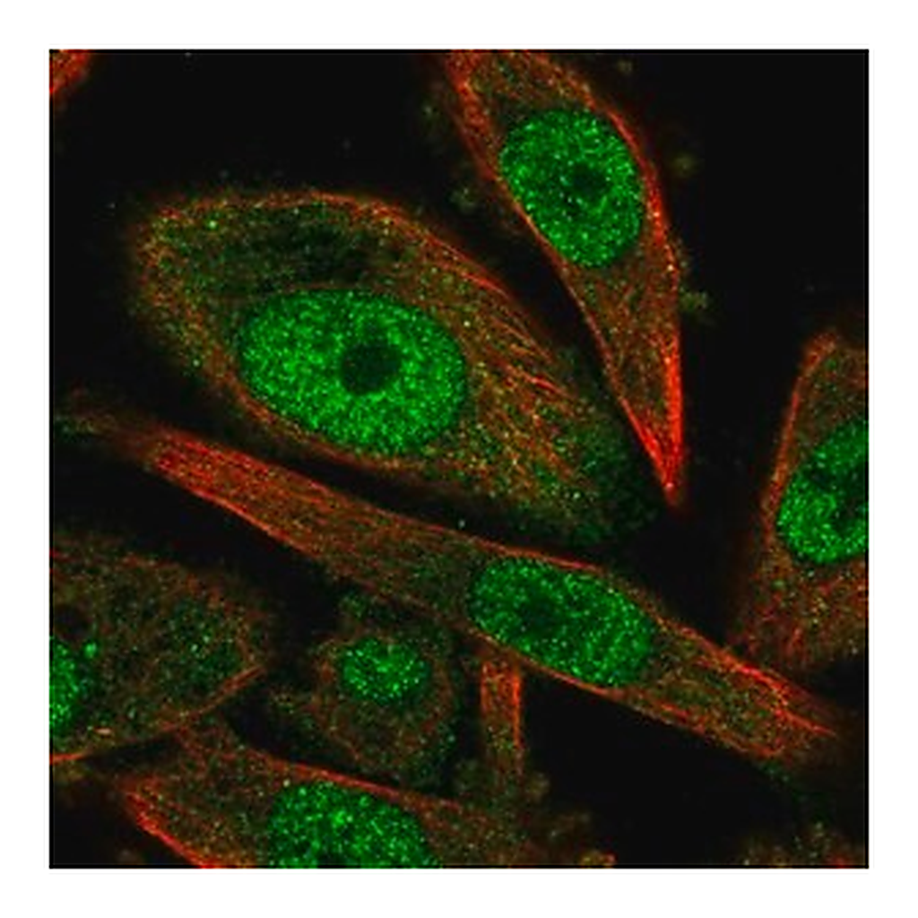 Merck Anti-CCNH antibody produced in rabbit