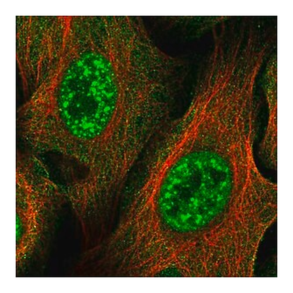 Merck Anti-ZNF337 antibody produced in rabbit