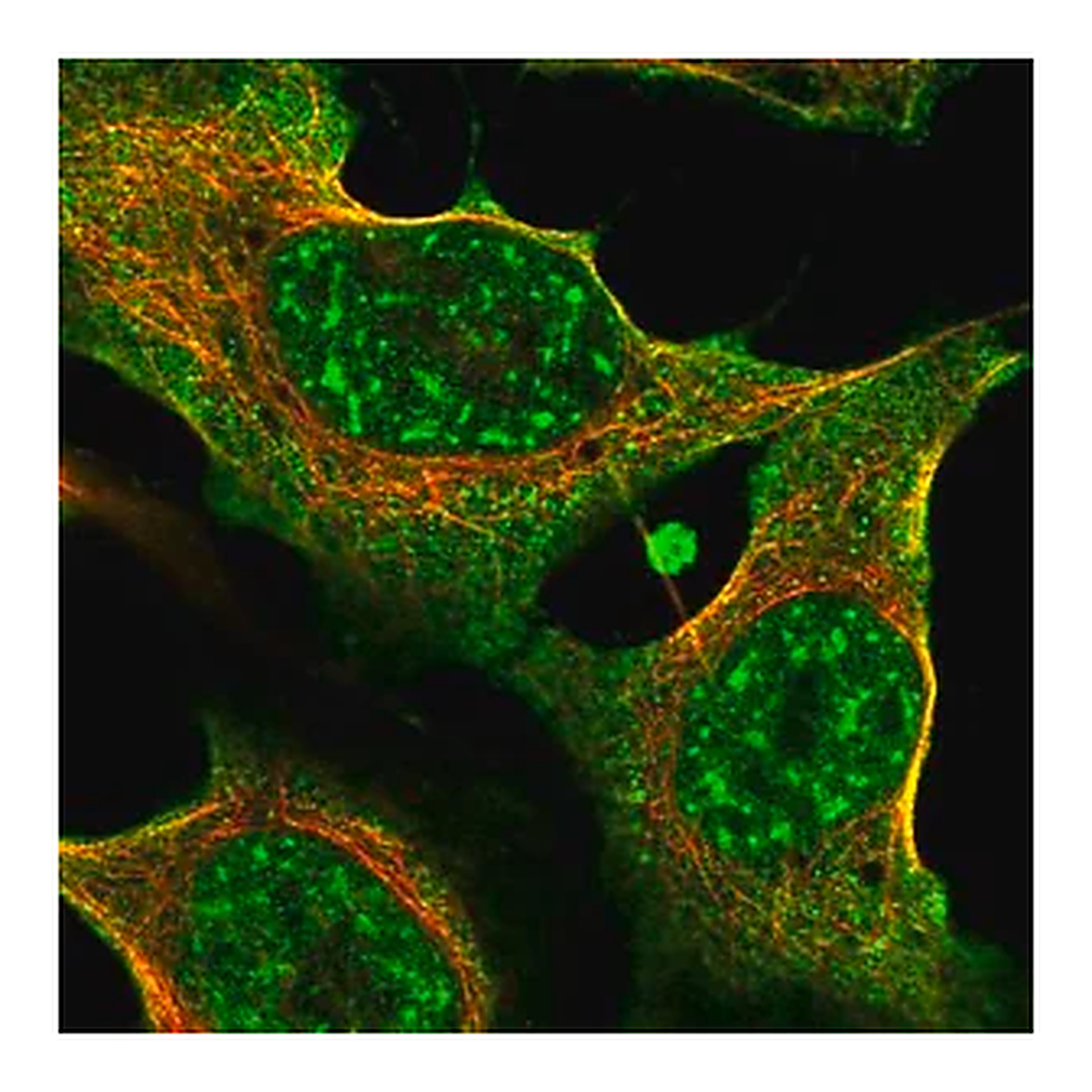 Merck Anti-THBS2 antibody produced in rabbit