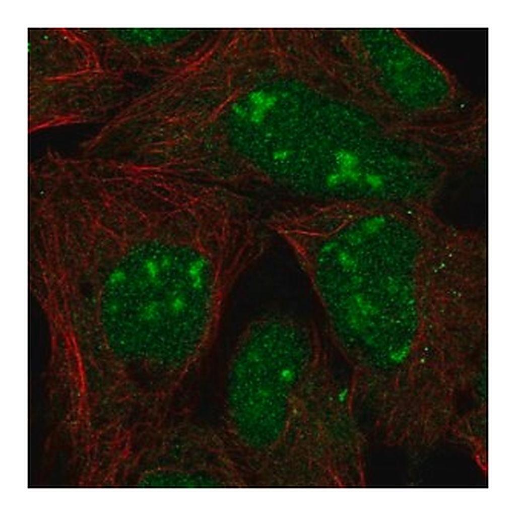 Merck Anti-L3MBTL3 antibody produced in rabbit