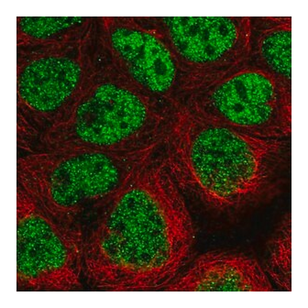 Merck Anti-CDK8 antibody produced in rabbit