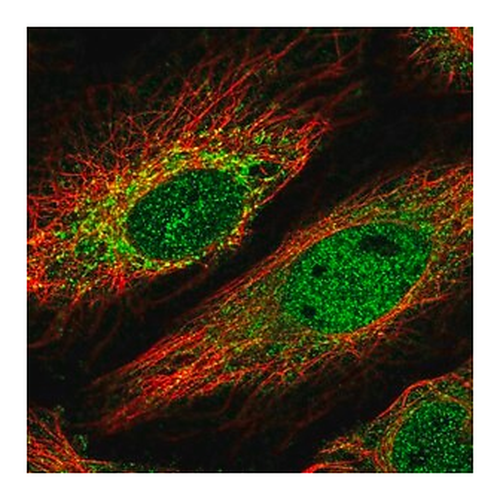 Merck Anti-HKR1 antibody produced in rabbit