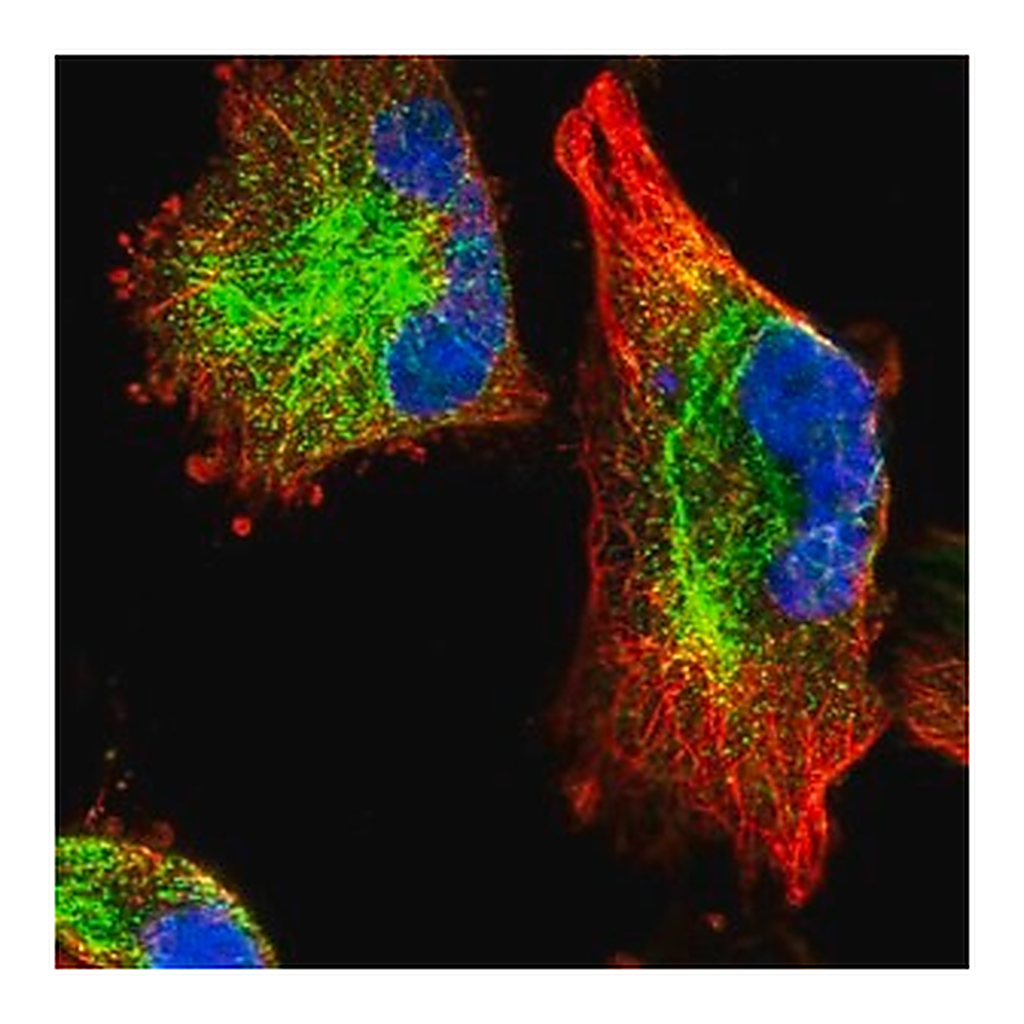 Merck Anti-C11orf95 antibody produced in rabbit