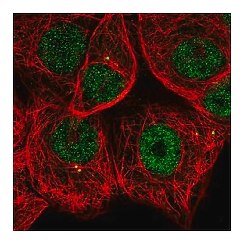 Merck Anti-MAPKAPK2 antibody produced in rabbit