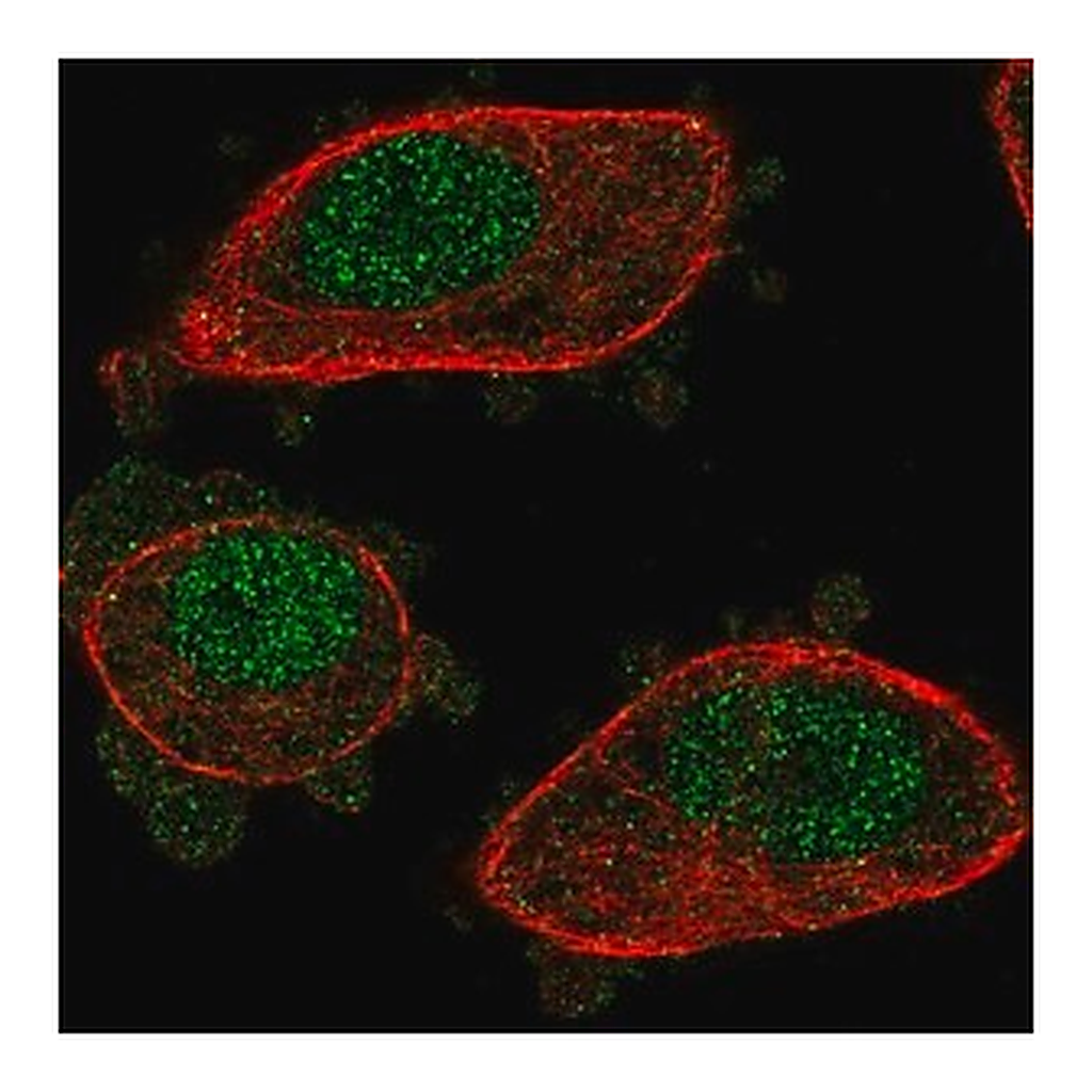 Merck Anti-NUDT2 antibody produced in rabbit
