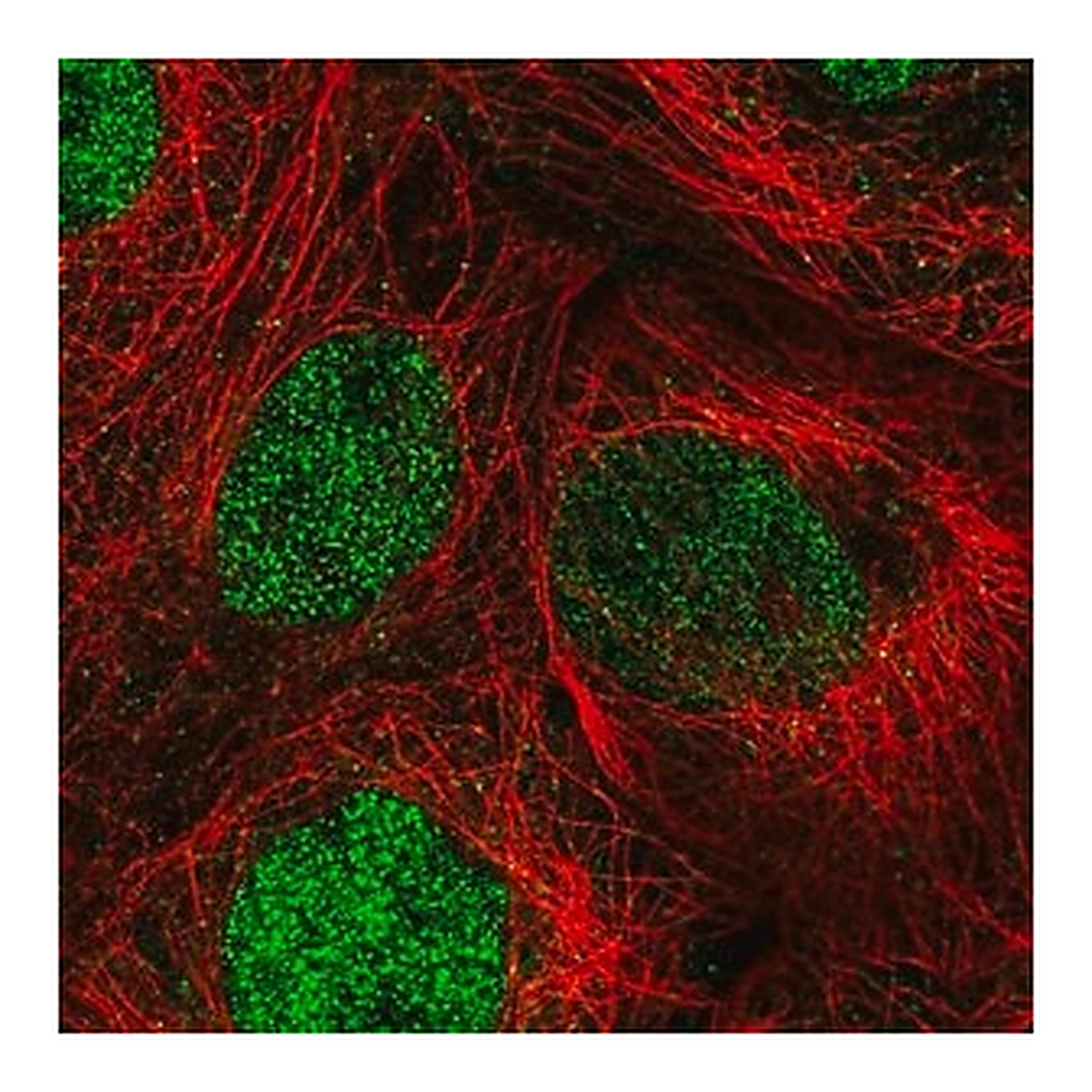 Merck Anti-DIS3 antibody produced in rabbit