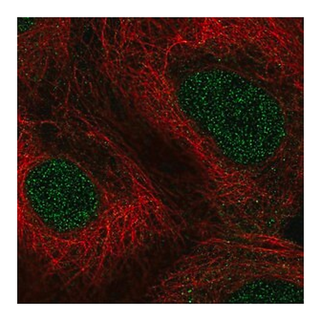 Merck Anti-PPARA antibody produced in rabbit