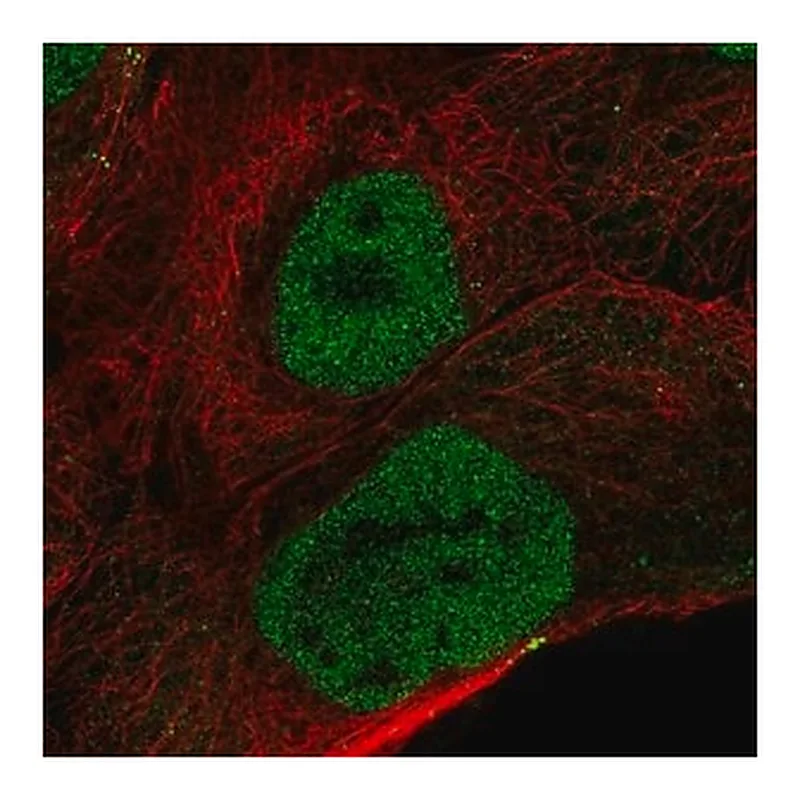 Merck Anti-OVCA2 antibody produced in rabbit
